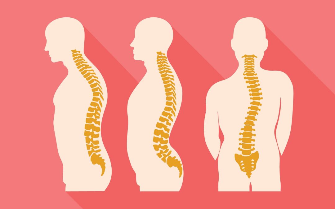 The Importance of Proper Spinal Curvature